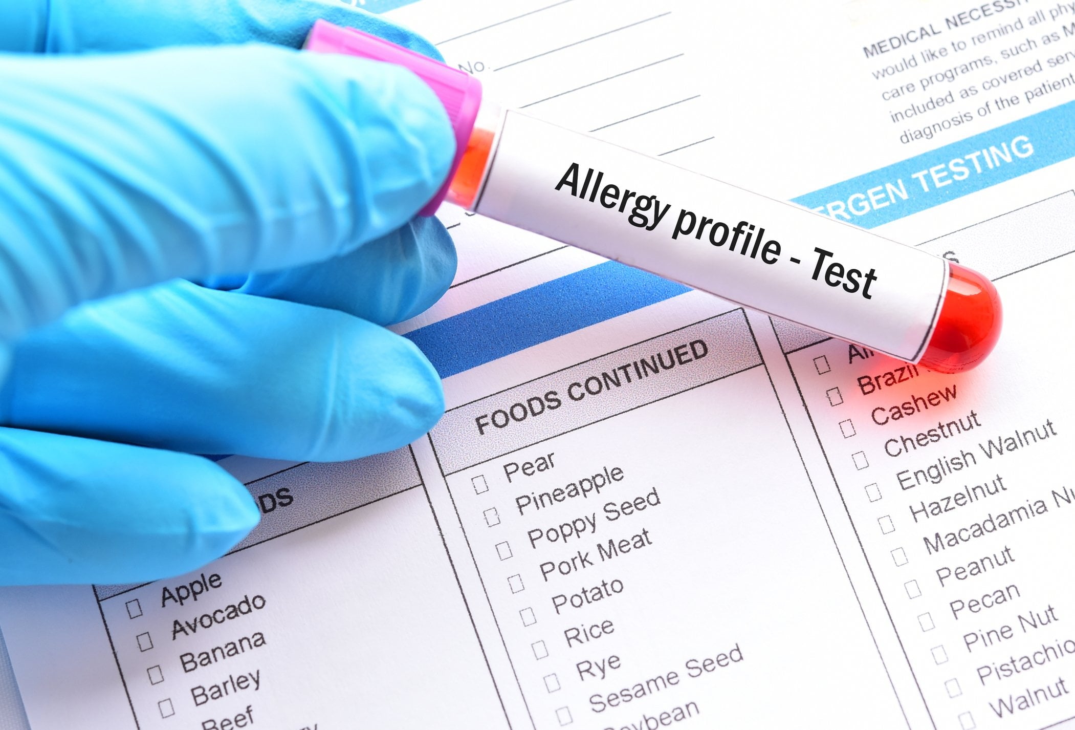 Food Allergies